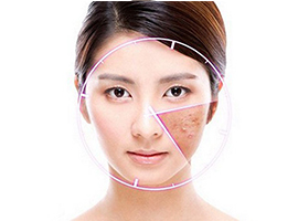 祛除顽固痘印有技巧 赶紧get起来