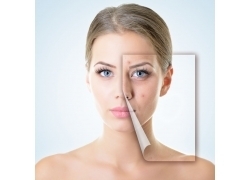 酸奶面膜能祛痘吗?要祛痘这样做!