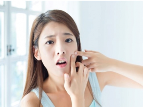 为什么痘痘都长你脸上了，别人脸上就不长呢?