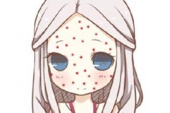 玛尚分享一些简单的痘痘护理方法!