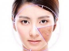 皮炎平可以快速祛痘?小心把自己糟蹋成激素脸