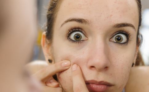 痘痘长了好几个月都不好?可能你长的是&ldquo;闷骚痘
