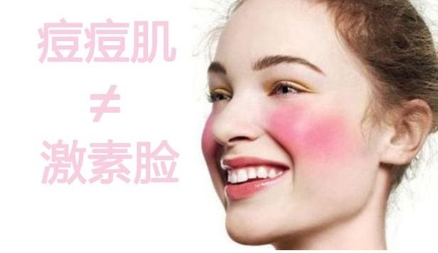 &ldquo;激素脸&rdquo;和&ldquo;痘痘肌&rdquo;都分不清，谈什么护肤