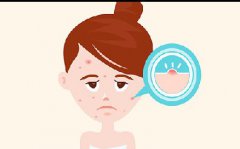 3块钱祛痘5块钱去黑头，被捧上神坛的药膏不靠谱